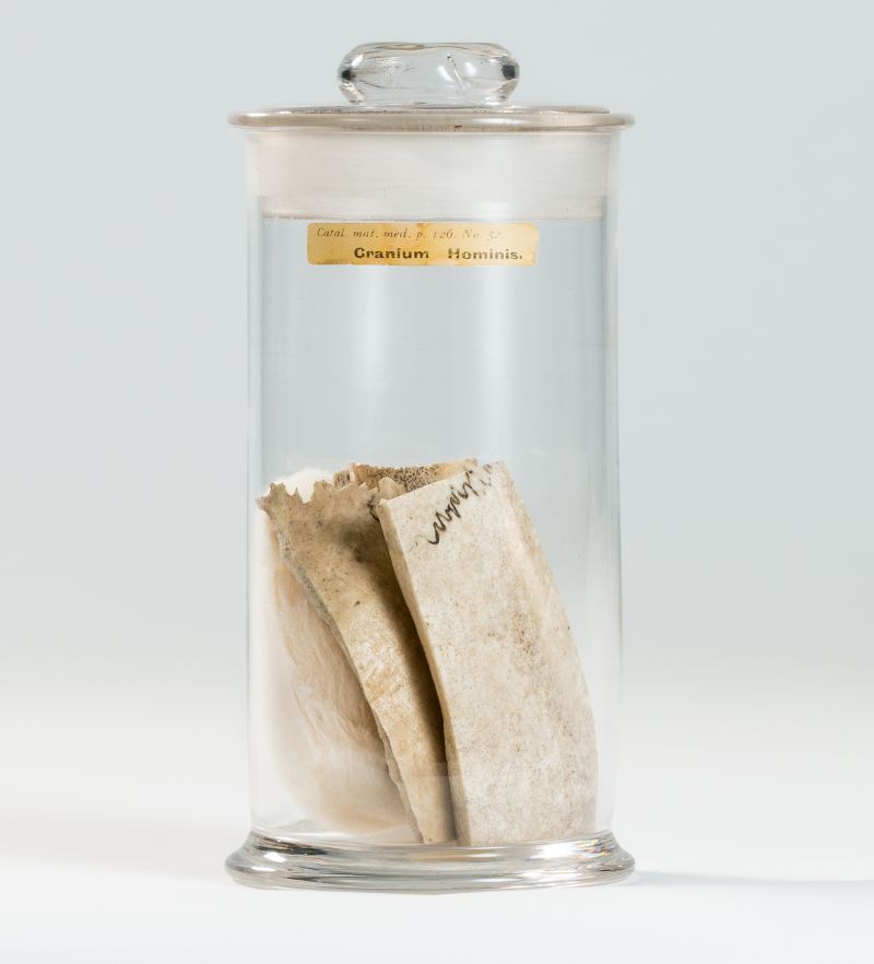 Medicine made from a human skull and used to treat epilepsy